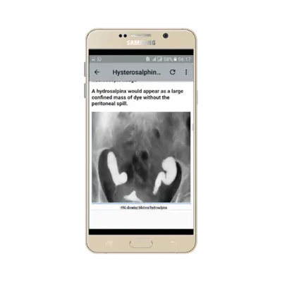 Obstetrics Procedures android App screenshot 0